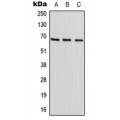 LifeSab™ HIC2 Rabbit pAb (50 µl)