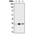 LifeSab™ ANP32C Rabbit pAb (50 µl)
