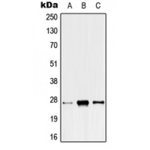 LifeSab™ ANP32C Rabbit pAb (50 µl)