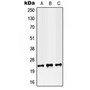 LifeSab™ RAB38 Rabbit pAb (50 µl)