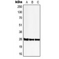 LifeSab™ 6PGL Rabbit pAb (50 µl)