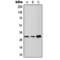 LifeSab™ Tryptase gamma Rabbit pAb (50 µl)