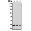LifeSab™ Thioredoxin 2 Rabbit pAb (50 µl)