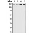 LifeSab™ CHD5 Rabbit pAb (50 µl)
