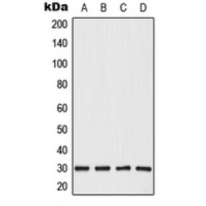 LifeSab™ CBP86 Rabbit pAb (50 µl)