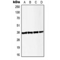 LifeSab™ LAT (pY191) Rabbit pAb (50 µl)