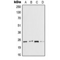 LifeSab™ IL-37 Rabbit pAb (50 µl)
