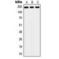 LifeSab™ ZNF638 Rabbit pAb (50 µl)