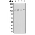 LifeSab™ HIPK2 Rabbit pAb (50 µl)