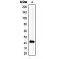 LifeSab™ MAGEC2 Rabbit pAb (50 µl)