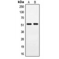 LifeSab™ PPHLN1 Rabbit pAb (50 µl)