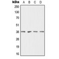 LifeSab™ DHRS7 Rabbit pAb (50 µl)