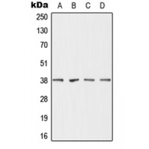 LifeSab™ DHRS7 Rabbit pAb (50 µl)