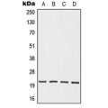 LifeSab™ OAZ3 Rabbit pAb (50 µl)