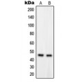 LifeSab™ GPRC5B Rabbit pAb (50 µl)