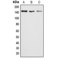 LifeSab™ ARID4B Rabbit pAb (50 µl)