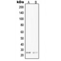 LifeSab™ PPP1R14D Rabbit pAb (50 µl)