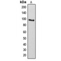 LifeSab™ ARHGAP17 Rabbit pAb (50 µl)