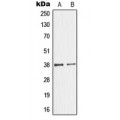 LifeSab™ GIMAP4 Rabbit pAb (50 µl)