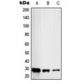 LifeSab™ RAB20 Rabbit pAb (50 µl)