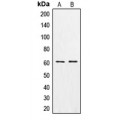 LifeSab™ CSGALNACT1 Rabbit pAb (50 µl)