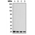 LifeSab™ CABP5 Rabbit pAb (50 µl)