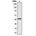 LifeSab™ CYSLTR2 Rabbit pAb (50 µl)