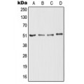 LifeSab™ RTN4R Rabbit pAb (50 µl)