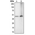 LifeSab™ LASS4 Rabbit pAb (50 µl)