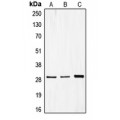 LifeSab™ CDCA3 Rabbit pAb (50 µl)