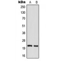 LifeSab™ TM2D1 Rabbit pAb (50 µl)