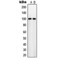 LifeSab™ NaBC1 Rabbit pAb (50 µl)