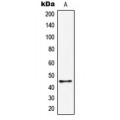 LifeSab™ HORMAD1 Rabbit pAb (50 µl)