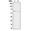 LifeSab™ ACRBP Rabbit pAb (50 µl)