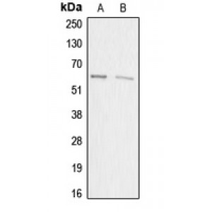 LifeSab™ ACRBP Rabbit pAb (50 µl)