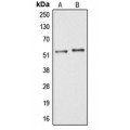 LifeSab™ ARMC6 Rabbit pAb (50 µl)