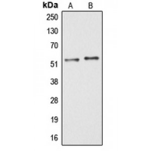 LifeSab™ ARMC6 Rabbit pAb (50 µl)