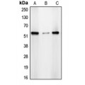 LifeSab™ CDYL2 Rabbit pAb (50 µl)