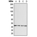 LifeSab™ CCBE1 Rabbit pAb (50 µl)