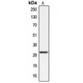 LifeSab™ ABCC13 Rabbit pAb (50 µl)
