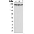 LifeSab™ GPR125 Rabbit pAb (50 µl)