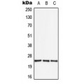 LifeSab™ APOBEC3A Rabbit pAb (50 µl)