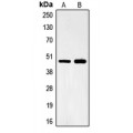 LifeSab™ FOXB2 Rabbit pAb (50 µl)