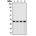 LifeSab™ FSBP Rabbit pAb (50 µl)