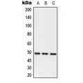 LifeSab™ Serpin A3 Rabbit pAb (50 µl)