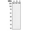 LifeSab™ ABCA1 Rabbit pAb (50 µl)