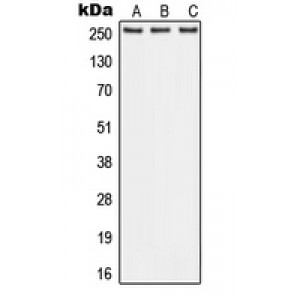 LifeSab™ ABCA1 Rabbit pAb (50 µl)