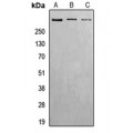 LifeSab™ ATM (pS1981) Rabbit pAb (50 µl)