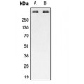 LifeSab™ ATM (pS1987) Rabbit pAb (50 µl)