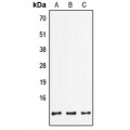LifeSab™ FXYD2 Rabbit pAb (50 µl)